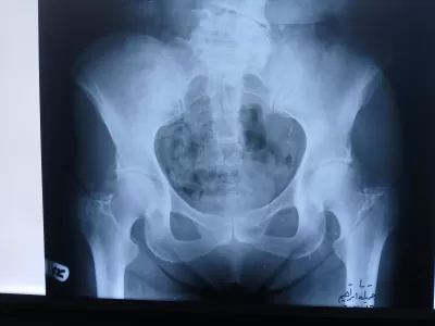 اعطيك معلومات مختصرة عن المرنان المغناطيسي