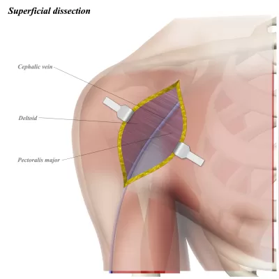 الكتابة باللغة العربية و اللغة الانجليزية
